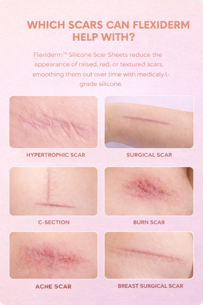 Flexiderm™ Silicone Collagen Repair Tape