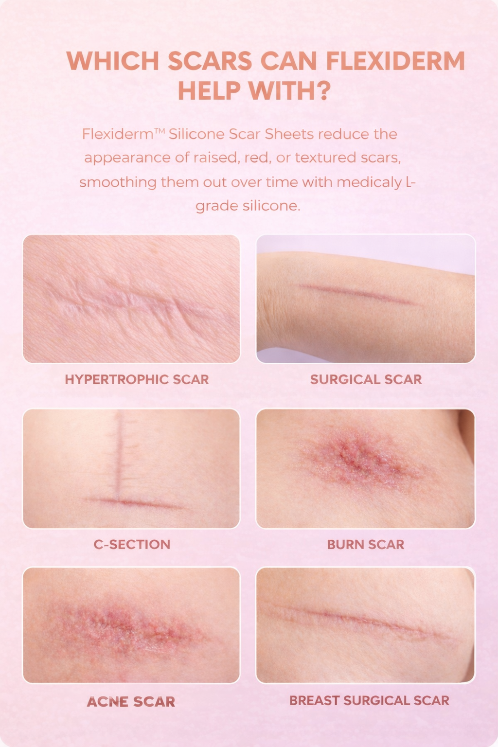 Flexiderm™ Silicone Collagen Repair Tape