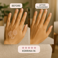 Flexiderm™ Silicone Collagen Repair Tape